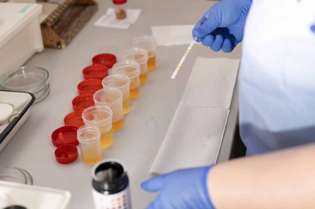 Analysis in a medical laboratory.