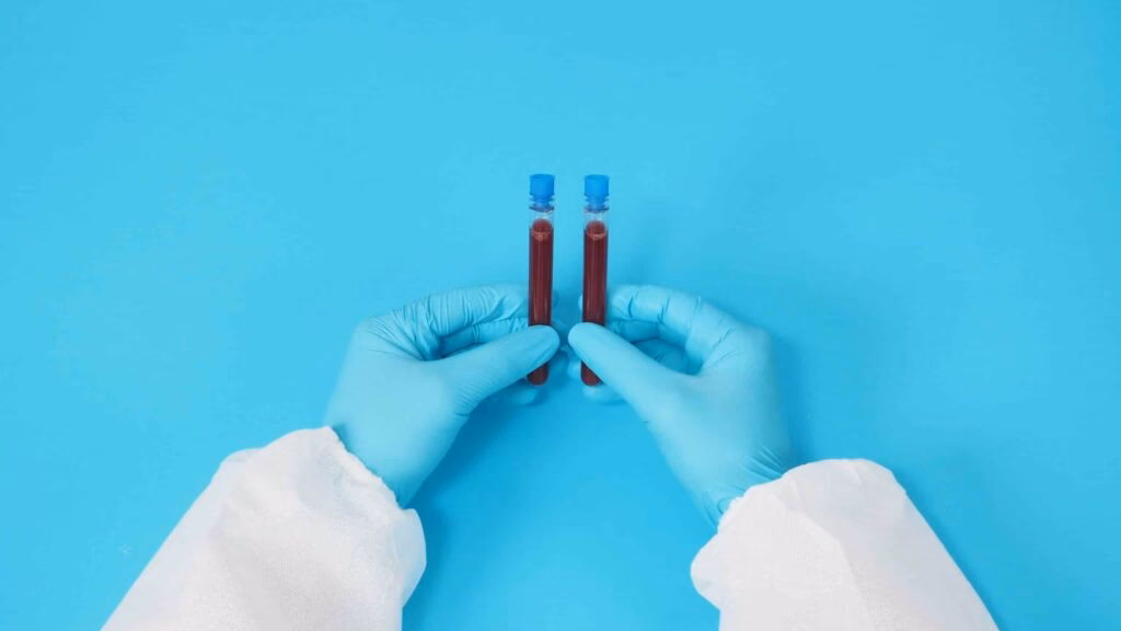 model with PPE suite and Hand with glove is holding blood test tube on blue background.
