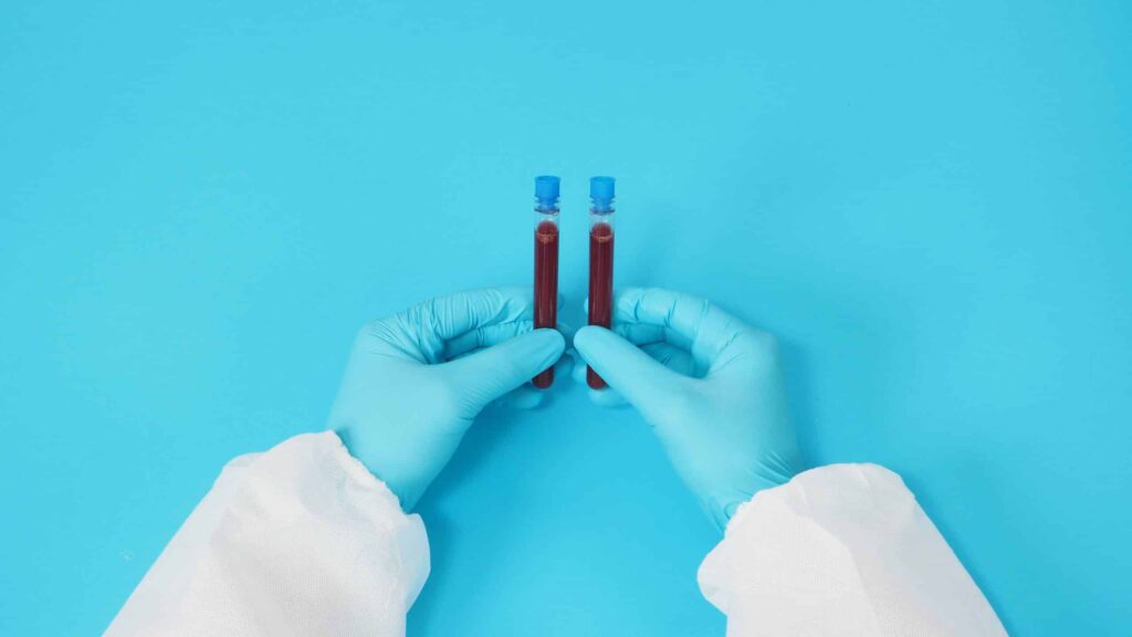 model with PPE suite and Hand with glove is holding blood test tube on blue background.